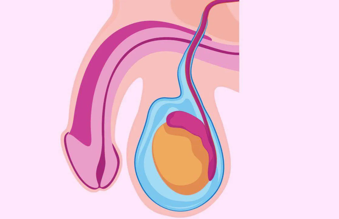 مراقبت‌های بعد از جراحی هیدروسل
