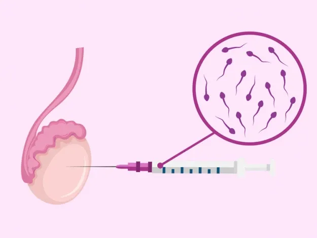 بیوپسی بیضه