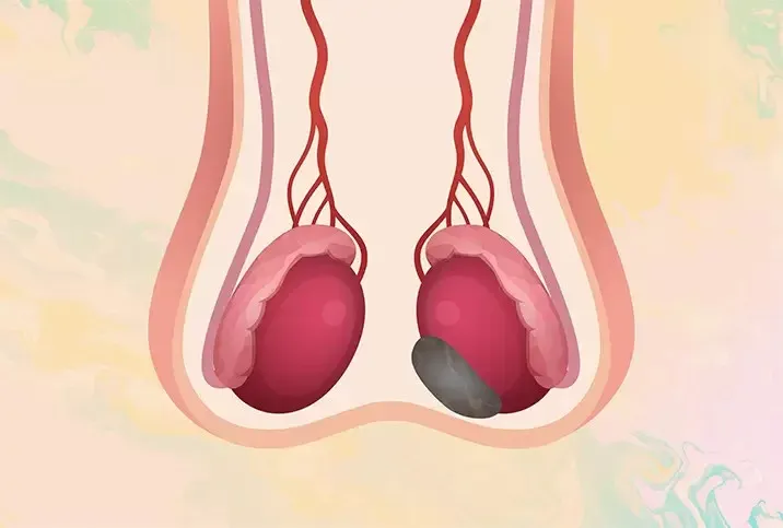 عفونت و بیماری بیضه