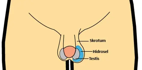 هیدروسل ثانویه