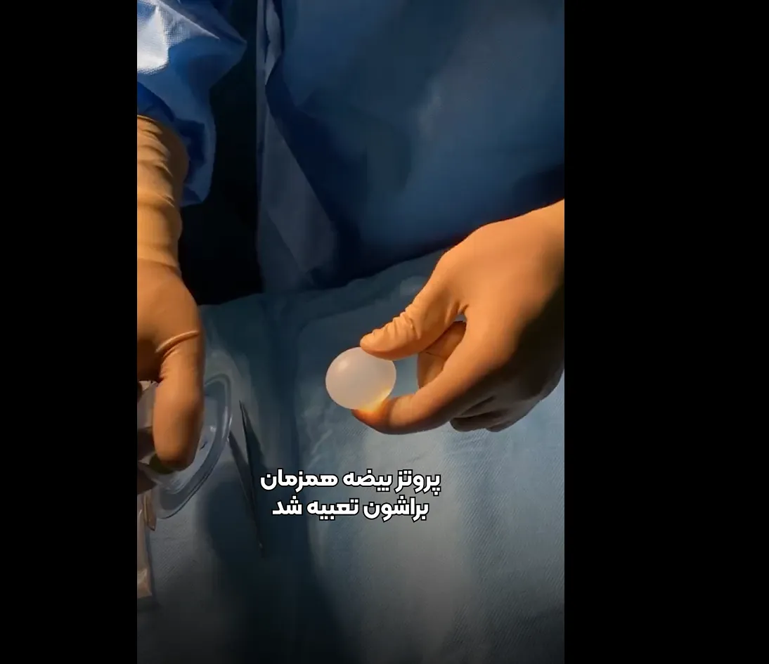 ویدئو جراحی پروتز بیضه